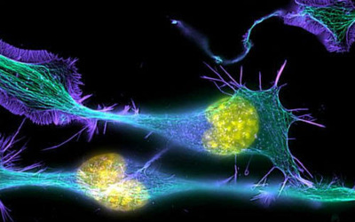 干细胞 技术革新引领疾病治疗新纪元